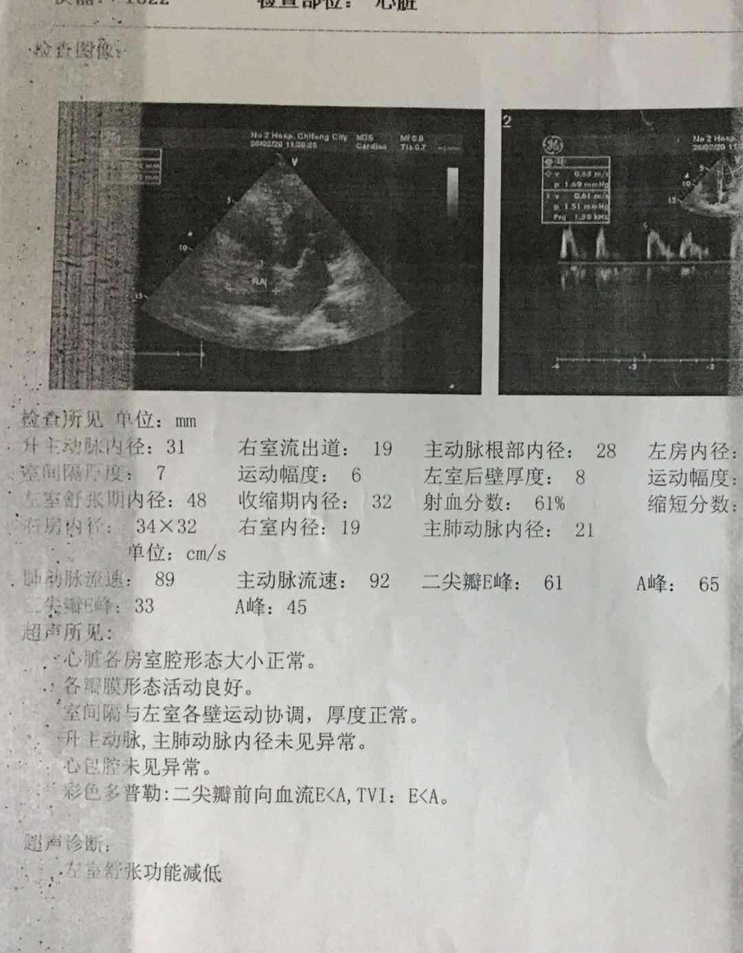 最新赤峰肺炎動(dòng)態(tài)，全面解讀與觀點(diǎn)闡述