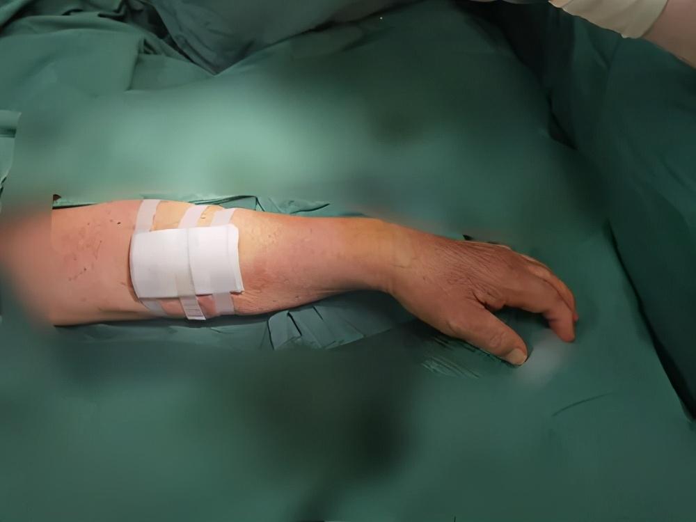 最新滌綸材料革新深度探討