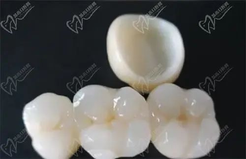 時(shí)代前沿的全瓷牙技術(shù)，齒科領(lǐng)域的革新之光